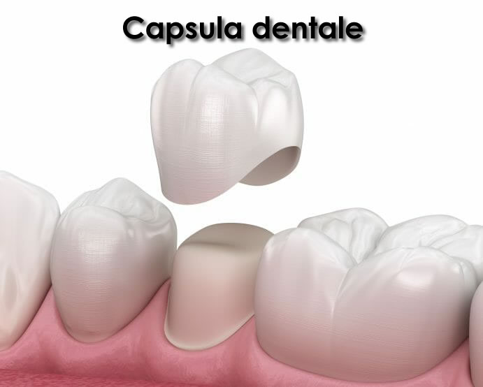 capsula dentale
