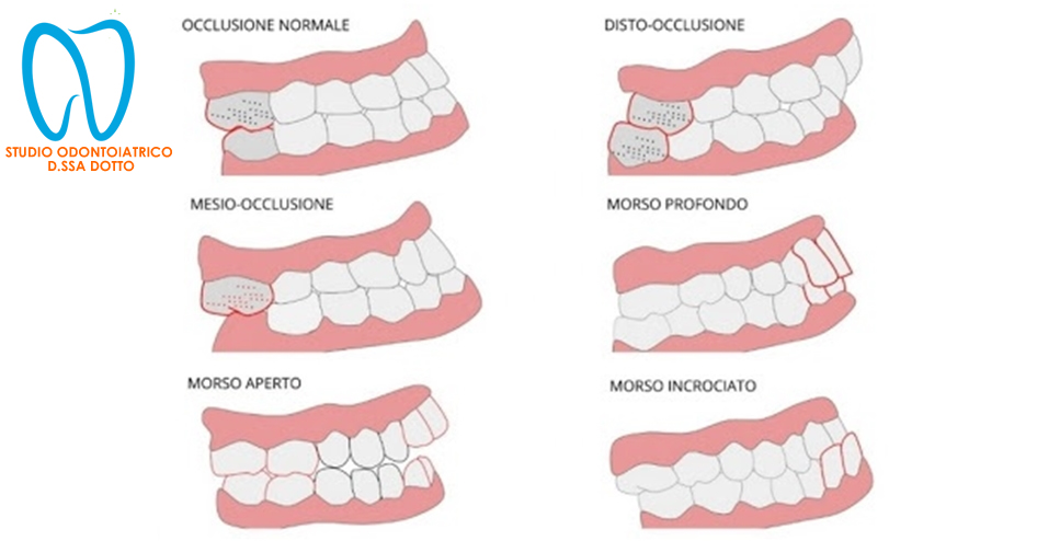 ortodonzia palermo